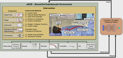 Endovascular Surgical Robot Platform (stEVE) featured image